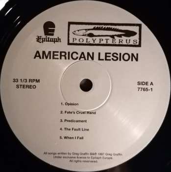 LP American Lesion: American Lesion 76589
