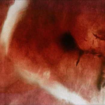 2LP Angles: The Death Of Kalypso