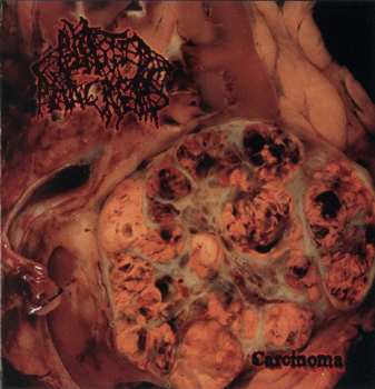 Album Blasted Pancreas: Carcinoma