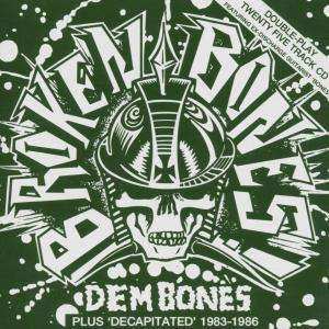 Album Broken Bones: Dem Bones