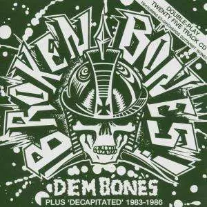 Broken Bones: Dem Bones