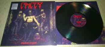 LP Cancer: Shadow Gripped