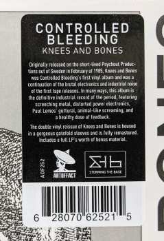 2LP Controlled Bleeding: Knees And Bones 131518