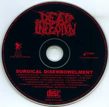 CD Dead Infection: Surgical Disembowelment 227826
