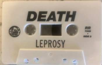 MC Death: Leprosy  313254