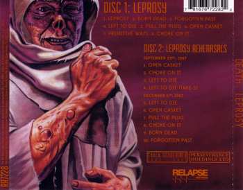 2CD Death: Leprosy 382432
