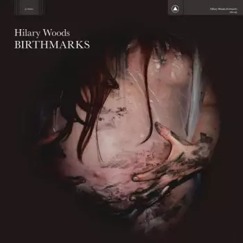 Hilary Woods: Birthmarks