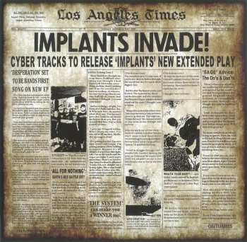 LP Implants: The Olden Age LTD | CLR 81745