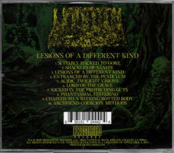 CD Undeath: Lesions Of A Different Kind 20086