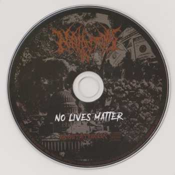 CD Nephrectomy: No Lives Matter 175280