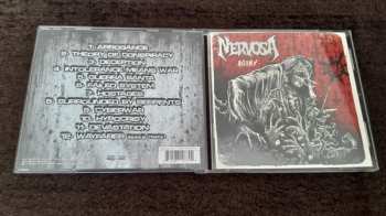 CD Nervosa: Agony 1406