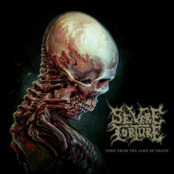 CD Severe Torture: Torn From The Jaws Of Death 536378