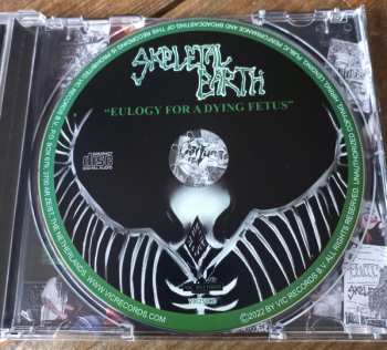 CD Skeletal Earth: Eulogy For A Dying Fetus 457925