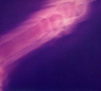 CD This Heat: Repeat